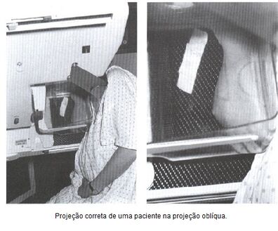 Mamografia6.jpeg