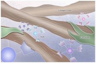 Complicacaovascular3.jpg