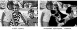 Complicacaovascular5.jpg