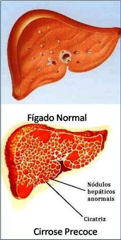 Arquivo:Figura3.jpeg.jpg