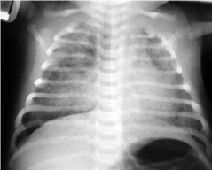 Resp.Neonato 2.jpg
