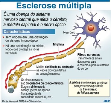 Arquivo:Esclerose2.jpg.jpg