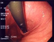 Endoscopia5