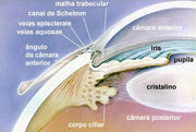Glaucoma3