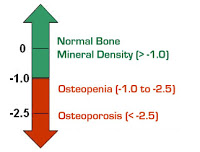 Osteoporose5.jpg