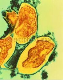 Tuberculose3.jpg