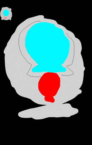 File:AbsolutelySafeCapsule.png