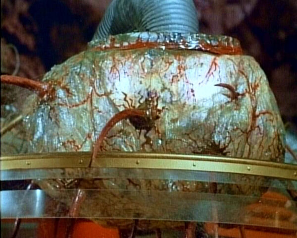 File:Computer brain.jpg