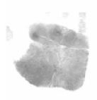 Palm