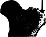 180px-70823-any2fbimgloader37