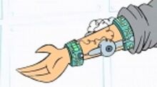 The bionic arm