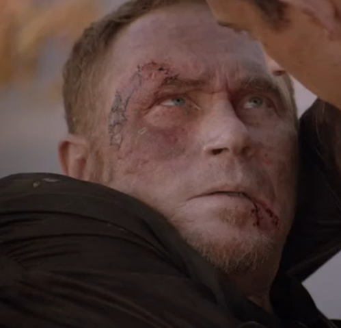 File:Placidi injured.png