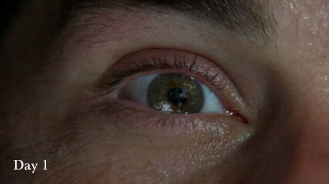 File:Eye1.jpg