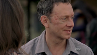 Ep6x16-FSTBensBruise