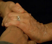3x11-amira-burn.jpg