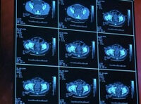 PregnancyPortal