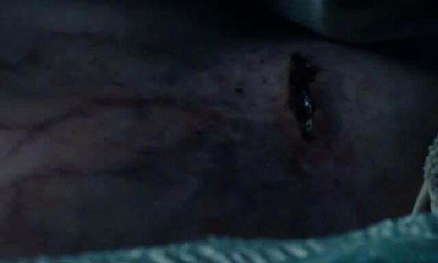 File:Morgul blade wound.jpg