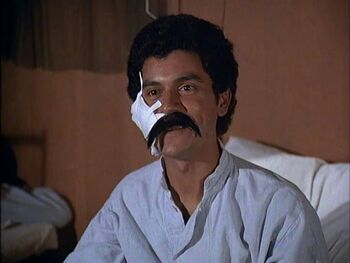 Robelo with mustache-post op