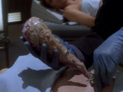 Bashir entnimmt Symbiont.jpg