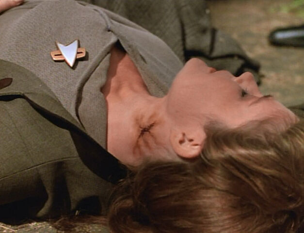 File:Janeway, neck burn.jpg