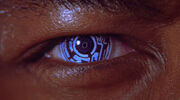Ocularimplant.jpg