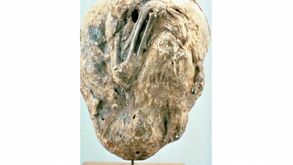 Extra large-1464366520-1630-calcified-fetus-found-in-woman-after-more-than-50-years