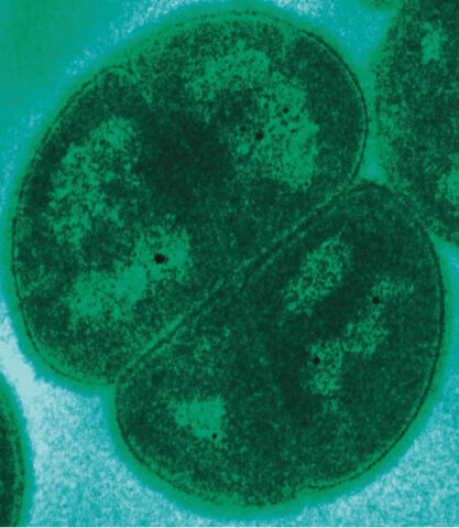 Fichier:Deinococcus radiodurans.jpg