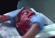 OHF - ER patient (played by Brent Sparks)