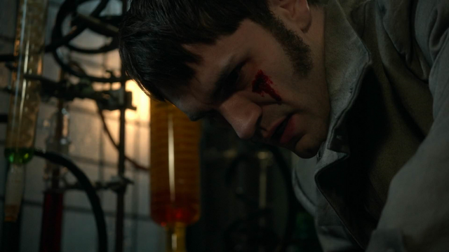 Fichier:5x22 Mr Hyde sang blessure visage réveil laboratoire.png