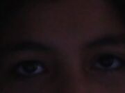 Scary racoon eyes