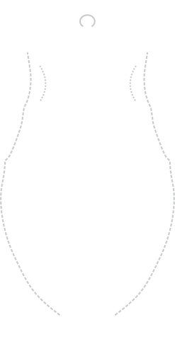 File:Phalangodes.png