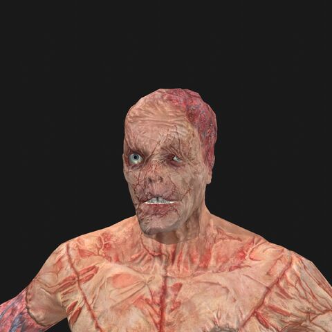 File:Patient14 face.jpeg