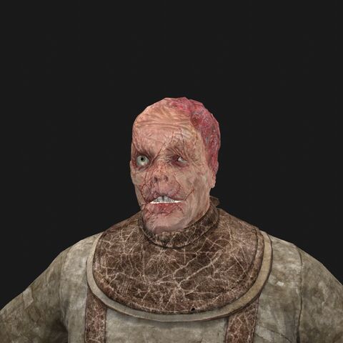 File:Patient11 face.jpeg