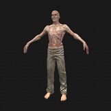 480px-Patient9 perspFront