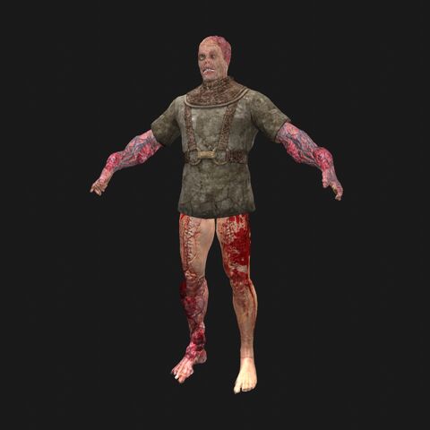 File:Patient11 perspFront.jpeg