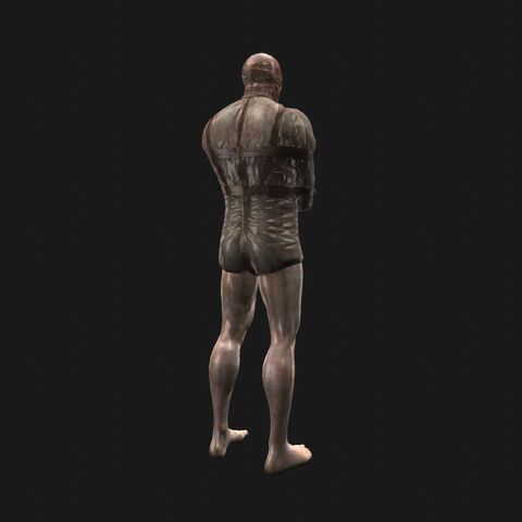 File:Patient15 perspBack.jpeg