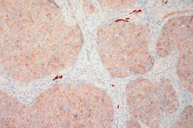 File:Inhibin.granulosa.euthman.jpg