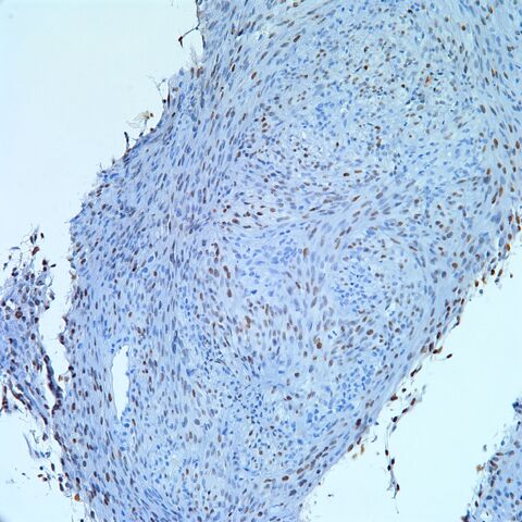 File:HHV-8.KS.3.jpg