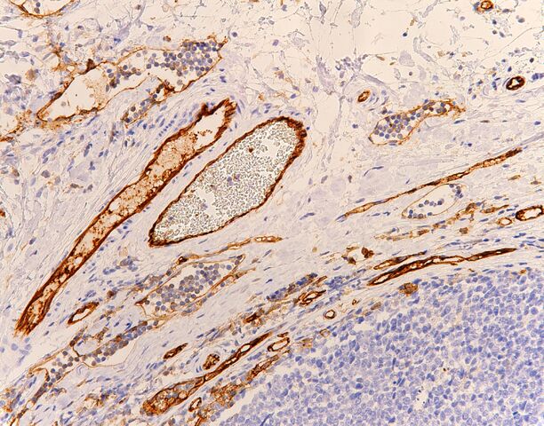 File:CD31.veins and lymphatics.normal.200x.jpg