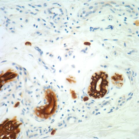 File:Pancytokeratin.mast cells.eccrine.jpg