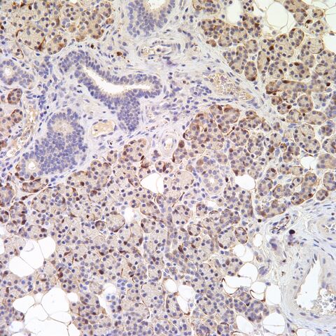 File:S100.myoepithelial.parotid.jpg