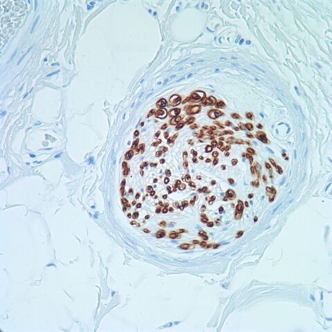 File:CD57.nerve.400x.jpg