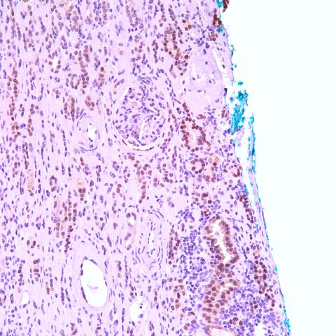 File:PAX-2.kidney.jpg