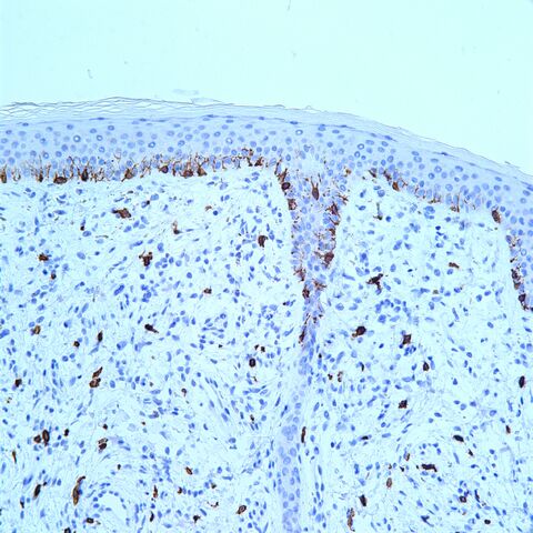 File:CD117.melanocytes.200x.basic.jpg