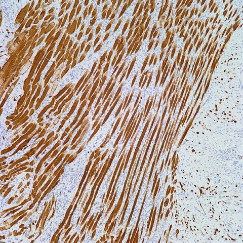 File:Desmin.skeletal muscle striations.100x.jpg