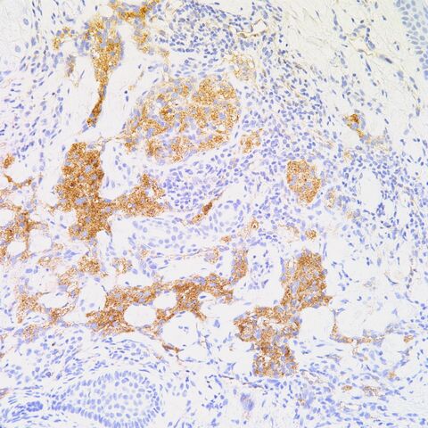 File:CD31.histiocytes.jpg