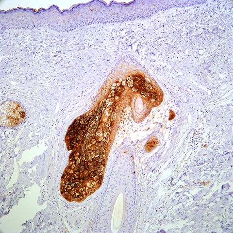File:EMA.sebaceous.jpg