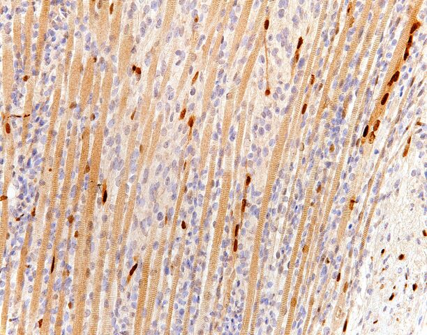 File:Myogenin.entrapped skeletal muscle.200x.1.jpg
