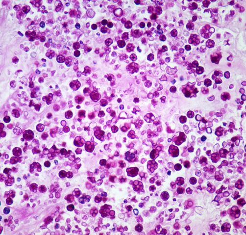 File:Prototheca.PAS Stain.1.jpg