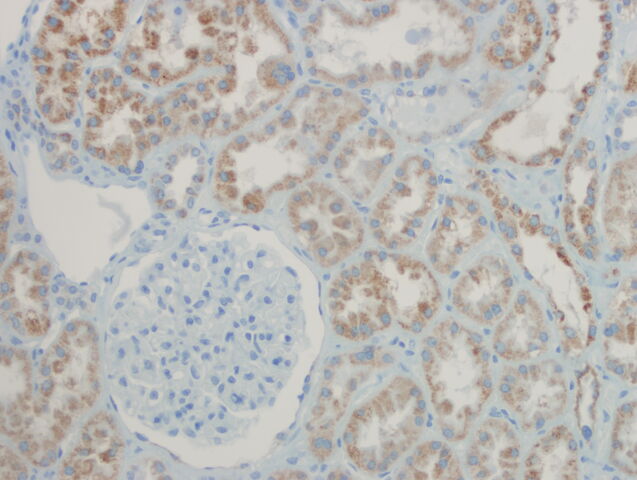 File:Napsin renal.jpg